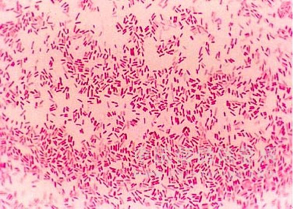 大肠杆菌的革兰氏染色图片